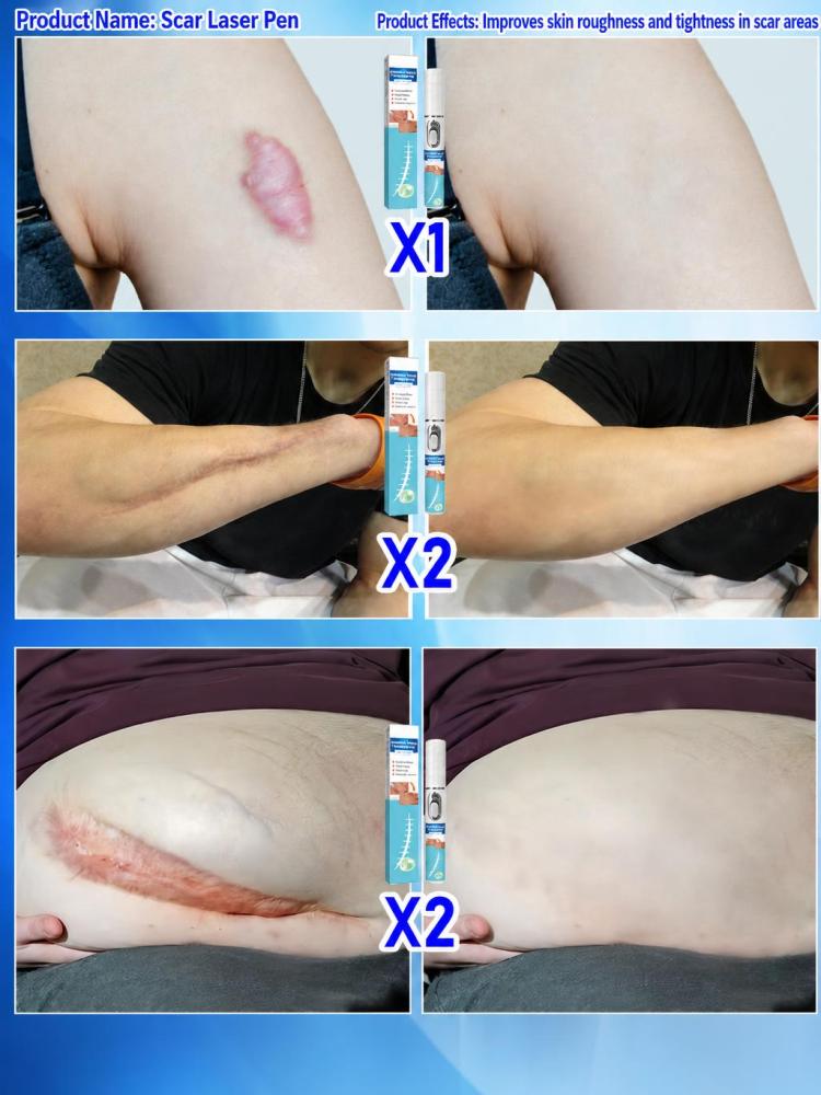 Handheld Skin Beauty Care Devi - đánh giá và giá Home Improvement Mark